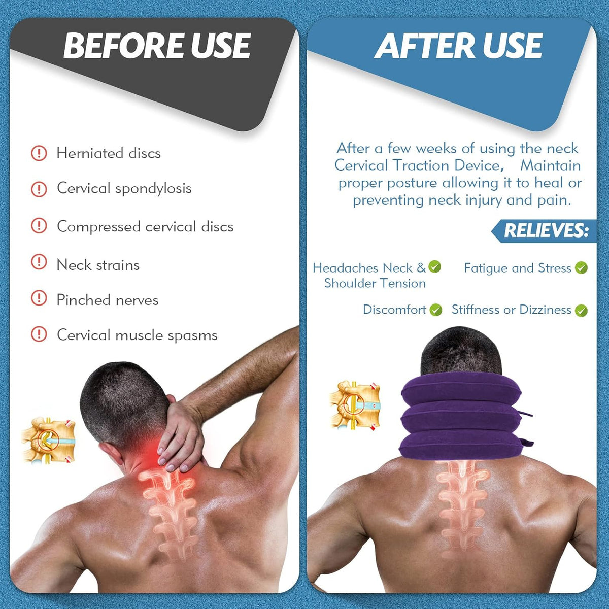 Neck Stretcher, Neck Traction Device for Neck Pain Relief
